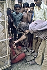 1975 Bangladesh. M Strassburg examines rash case