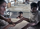 1975 Bangladesh. T Ward and patient