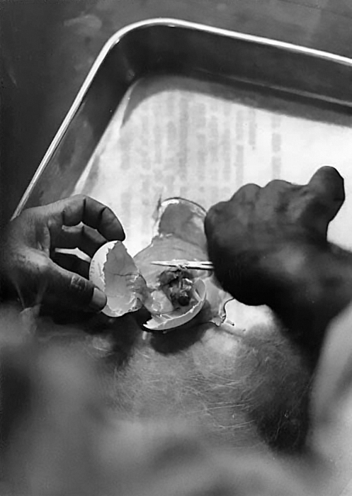 1965 Bangladesh. Removing the chorioallantoic membrane