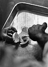 1965 Bangladesh. Removing the chorioallantoic membrane